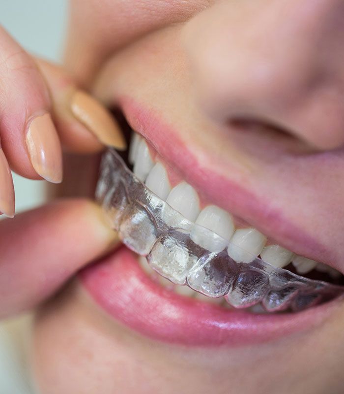 implantes dentales en córdoba 