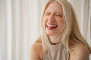 Dientes blancos blanqueamiento dental